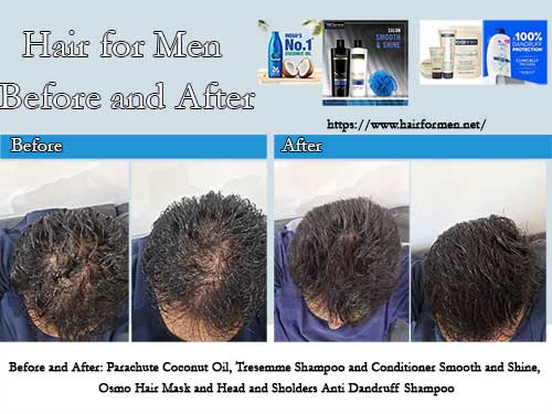 hair for men before and after