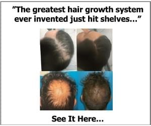 TruVarin Hair Growth 